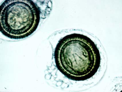 Embryonated, infectious taeniid eggs Hexacanth larva Hooklets Egg