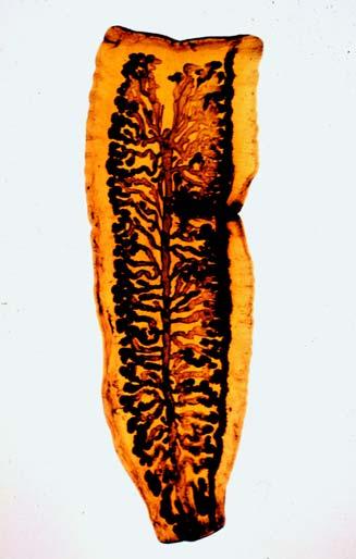 Gravid Proglottid of Taenia saginata Uterine branches Uterus The central