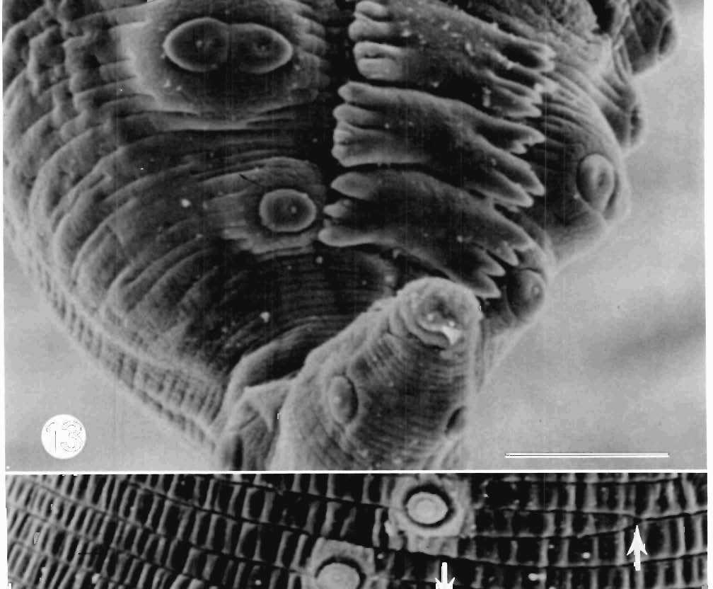 Scanning electron micrographs of
