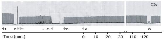 antivenom at a venom:antivenom ratio of 1.5mg of venom to 1.0ml of antivenom, totally abolished the venom-induced neuromuscular blockade in both preparations (Figure 6). DISCUSSION M.
