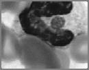 Ehrlichia ewingii Obligate, intracellular bacterium Granulocytes (neutrophils of mammalian host) Causative agent of canine granulocytic ehrlichiosis (CGE) and human granulocytic ehrlichiosis (HGE)