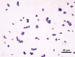Staphylococcus aureus Community and nosocomial Infection types: Skin and soft tissue Bone/joint