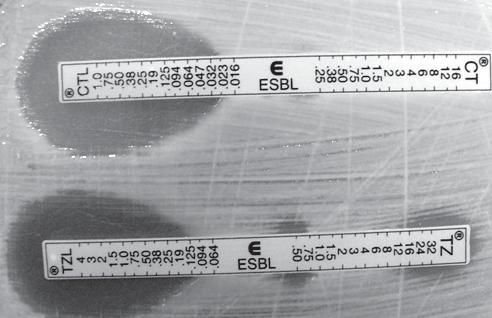 BJID 2008; 12 (December) ESBL Detection in Trinidad & Tobago 519 Figure 1. Detection of ESBL carriage with an E-test ESBL strips. Ceftazidime MIC against E.