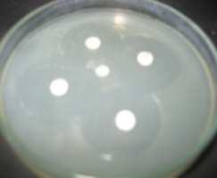 pyogenes S. aureus E.coli P.