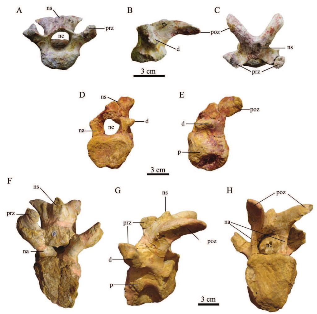 Figure 4.13 Anterior cervical vertebrae, MC-M30 in anterior (A), left lateral (B) and dorsal (C) views, CM-679 in anterior (D) and left lateral (E) views.