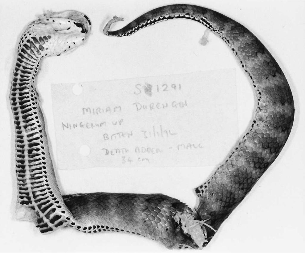 30 D.G. Lalloo et al. Figure 5. Death adder (34 cm long) responsible for envenoming patient S1492 (Case report 1) at Ningerum, Western Province, Papua New Guinea. she arrived at the hospital, 3.