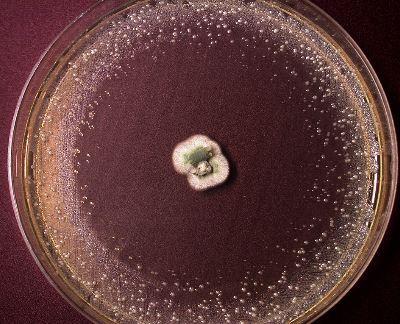 Plate of Staphylococcus aureus