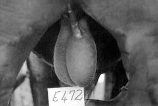 >> Foto 1: Raphe scroti heg aan sak van regter testikel en draai skrotum linksom wees, koeksister testes (Foto 3) waar dit voorkom asof die