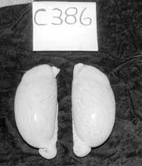>> >> Foto 7: Testes vanuit koeksister skrotum, heeltemal normaal Foto 8: Duidelike hipoplasie waar linker testikel merkbaar kleiner is as regter testikel gevolgtrekking gekom dat hierdie