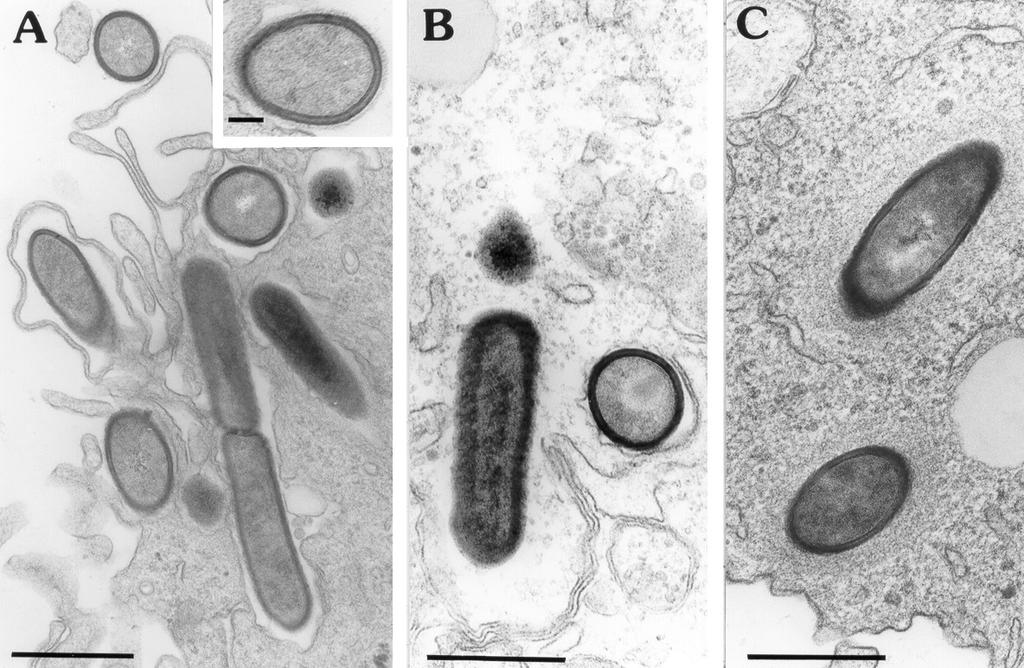 Following the intracellular fate of Listeria m.