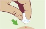 Do not pull or twist a tick otherwise it starts to choke more fluids with viruses