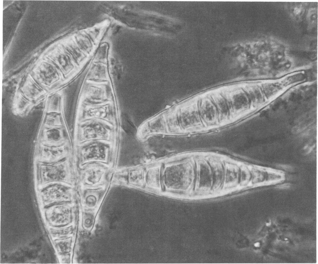 VOL. 16, 1982 M. EQUINUM IN NORTH AMERICA 945 Downloaded from http://jcm.asm.org/ FIG. 3. Spindle-shaped, verrucose, thick-walled macroconidia of M. canis (X850).