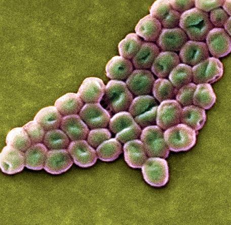Multi-drug resistant Acinetobacter baumannii Gram-negative bacteria that causes infections in critically ill patients, with mortality rates as high as 43% 1 CDC Unmet Need Threat Level: Serious 2 63%