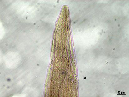 Fig.4. Skrjabinodon medinae female anterior post bulbar vulva 10.