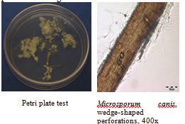Trichophyton mentagrophytes is usually urease positive in 7 days and Trichophyton rubrum is usually urease negative.