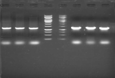 The results of PCR and biochemical techniques to determine the species of Brucella: After performing PCR, the results indicate the detection of Brucella isolated from patients can be seen in Figure