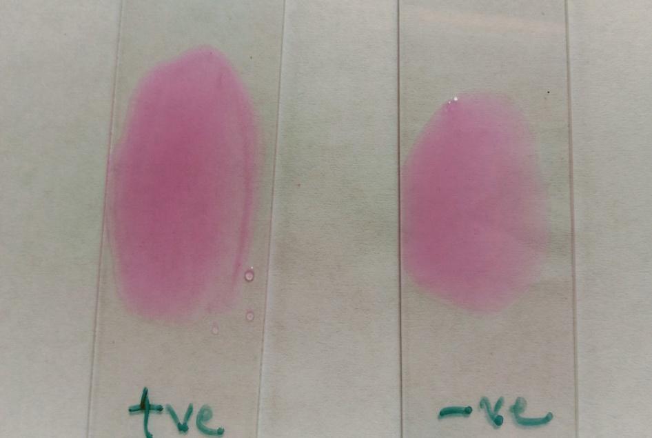 Screening of samples The serum samples were screened for Brucellosis by RBPT using Rose Bengal Antigen obtained from IVPM at Ranipet, Tamil Nadu.
