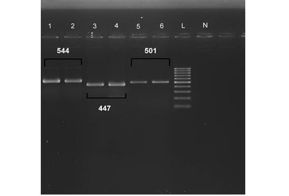 3%) respectively, also 57/60(95%) of isolates were positive for existence of OXA-23 gene (Figure 3). Later, confirmation of all PCR products was done after comparison to the databank.