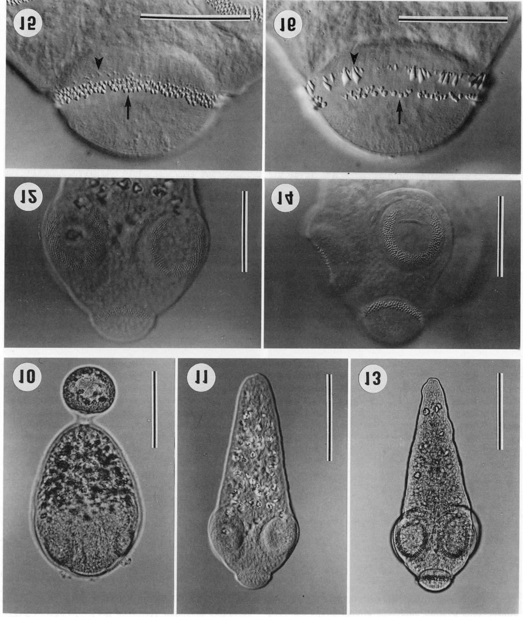 Figs. 10-16. Gangesia parasiluri. Fig. 10. Procercoid from experimentally infected Mesocyclops leuckarti, living, 9 days post infection at 20 C. Scale bar = 0.1 mm. Figs. 11, 12.