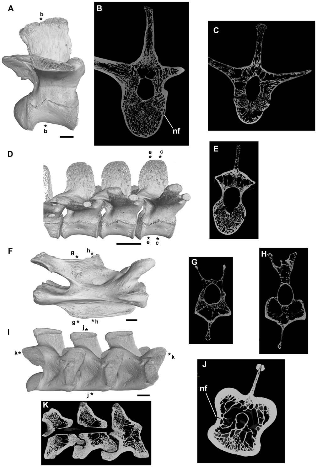 Figure 3. Vertebrae of extant reptiles lacking postcranial skeletal pneumaticity. A, B: Alligator mississippiensis, NHMUK RR 73.2.21.2, right lateral view (A) and transverse section (B).