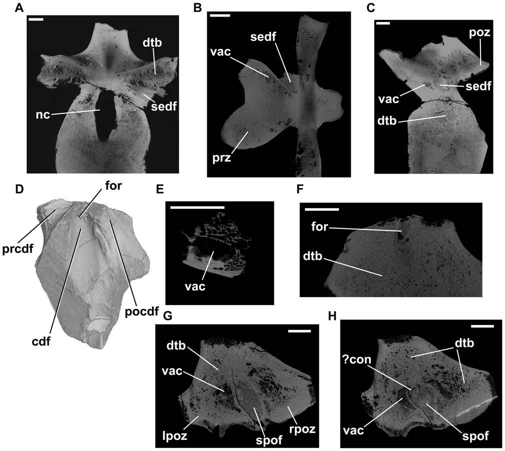 Figure 6. Erythrosuchus africanus, vertebrae and vertebral fragments.