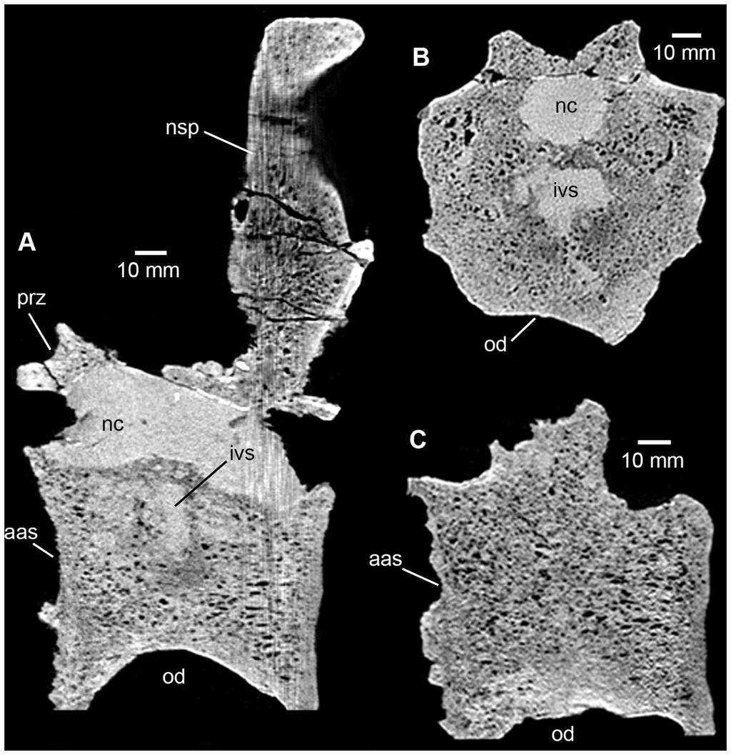 Spondyloarthropathy in a Phytosaur Figure 8. Phytosauria indet. from the Late Triassic of Halberstadt. CT scans of the fused vertebrae MB.R.1973. A.