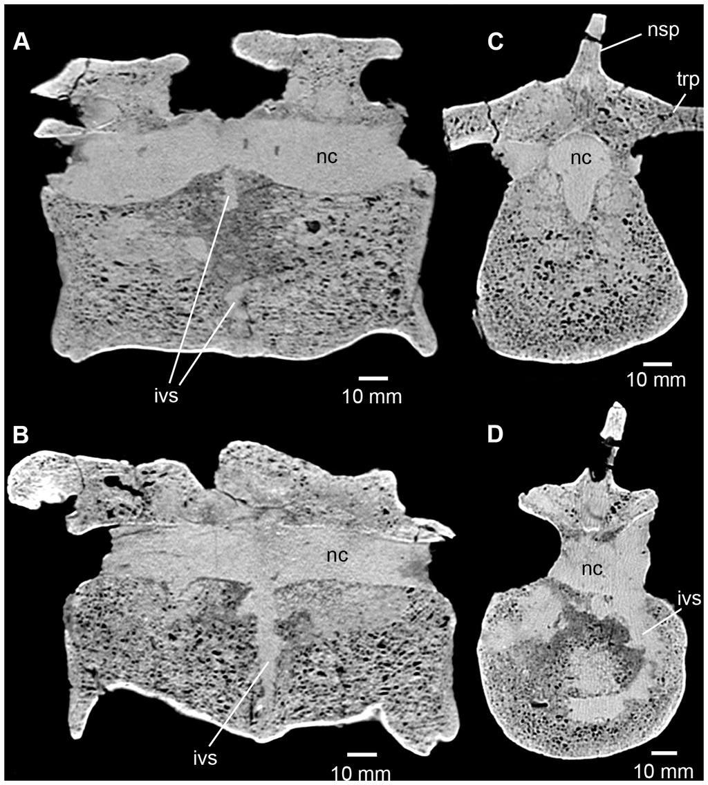 Spondyloarthropathy in a Phytosaur Figure 7. Phytosauria indet. from the Late Triassic of Halberstadt. CT scans of the fused vertebrae MB.R.1972. A.