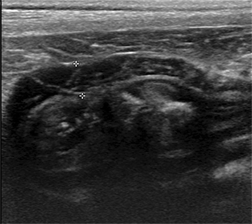Page 2 of 7 Fig. 1 Sagittal ultrasonographic image of the stomach of a dog from the prospective study.