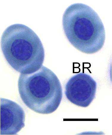 Chapter 2: Erythrocyte types developmental stages (rubriblasts and prorubricytes) and could not