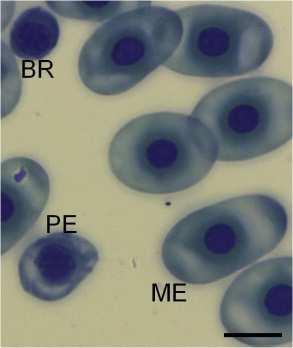 Chapter 2: Erythrocyte types A. B. C. D. E. F. G. H. Figure 2.