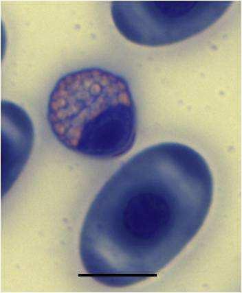 heterophil with a pseudopod and cytoplasmic inclusions and (d) a toxic heterophil on the left with a