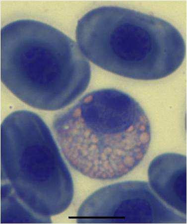 (e) Eosinophils have round granules and an off-centric nucleus with a single nucleolus, or (f) multiple
