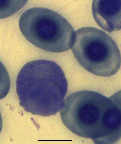 The peripheral blood occasionally contained lymphocytes with cytoplasmic protrusions (Fig. 4.2c). A. B. C.
