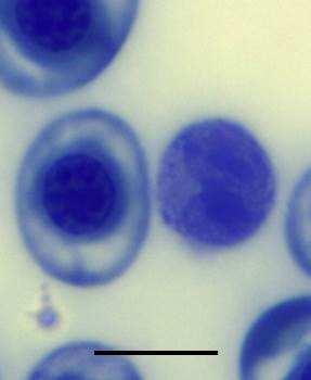 (a) A lymphocyte showing a large nucleus and thin rim of cytoplasm, (b) two lymphocytes of varying size,