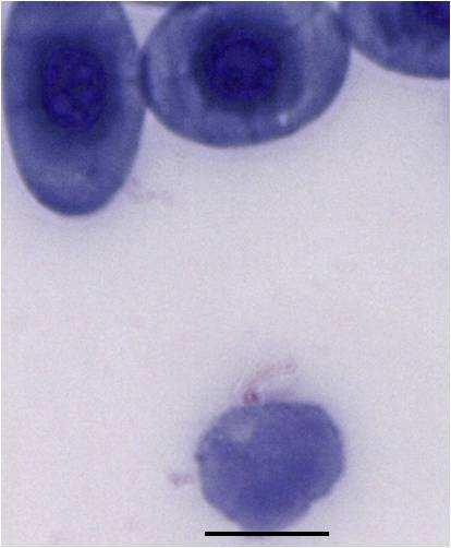 basophilic granular cytoplasm and (h) an azurophil.