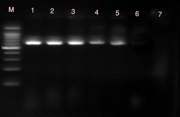 Phenotypic testing of Metallo-β-lactamases production by combined disk tests (CDTs) was done to 28 (51.