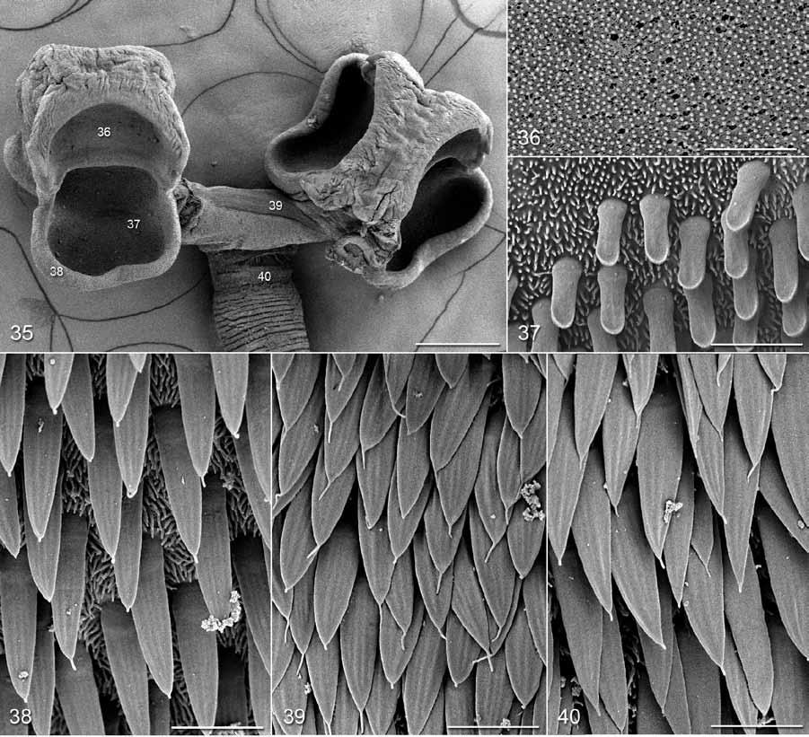 Desjardins, Caira: Three new species of Spiniloculus Figs. 35 40. Scanning electron micrographs of Spiniloculus paigeae sp. n. Fig. 35. Scolex.