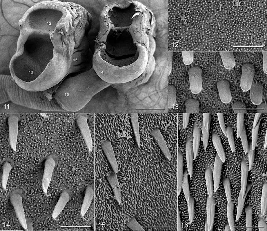 Figs. 11 16. Scanning electron micrographs of Spiniloculus calhouni sp. n. Fig. 11. Scolex. Note: small numbers correspond to the figures showing higher magnification images of these surfaces. Fig. 12.