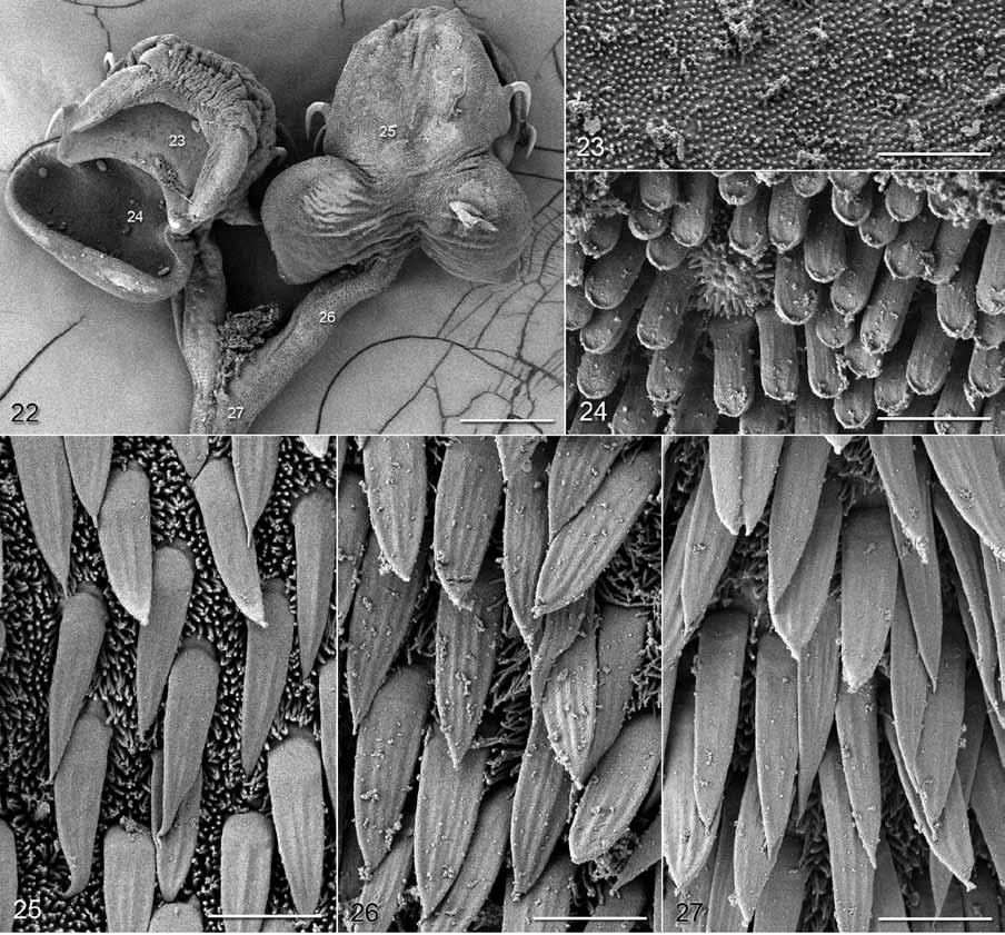 Figs. 22 27. Scanning electron micrographs of Spiniloculus fylerae sp. n. Fig. 22. Scolex. Note: small numbers correspond to the figures showing higher magnification images of these surfaces. Fig. 23.