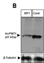 Enzyme in Biosynthesis of Phosphatidylcholine CDP-DAG PS PE Phosphatidylcholine PC Inositol CPT PI CDP- Ethanolamine CDP- Choline p-ethanolamine HcPMT1/2 PfPMT PCT p- Choline EK Hb SD Serine