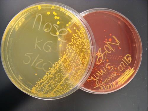 Classification S. aureus.: causes most staphylococcal disease. most important pathogen responsible for most human infections. S. epidermidis.
