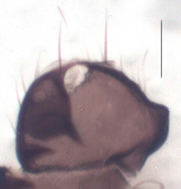aedeagal complex in dorsal view,