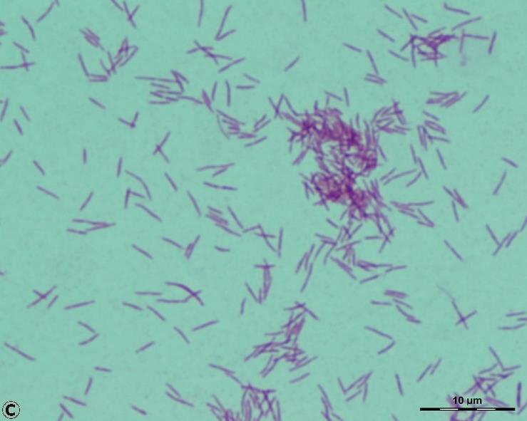 Propionibacterium acnes Gram + anaerobic rod Capnocytophaga Gram