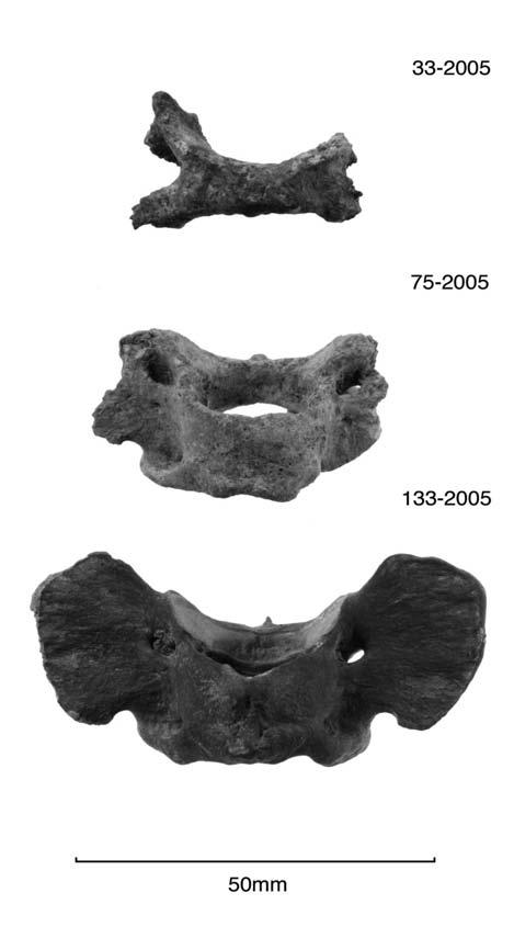 464 Islands of Inquiry / Graeme Taylor and Geoffrey Irwin Figure 11. Three C1 cervical vertebrae (axes).