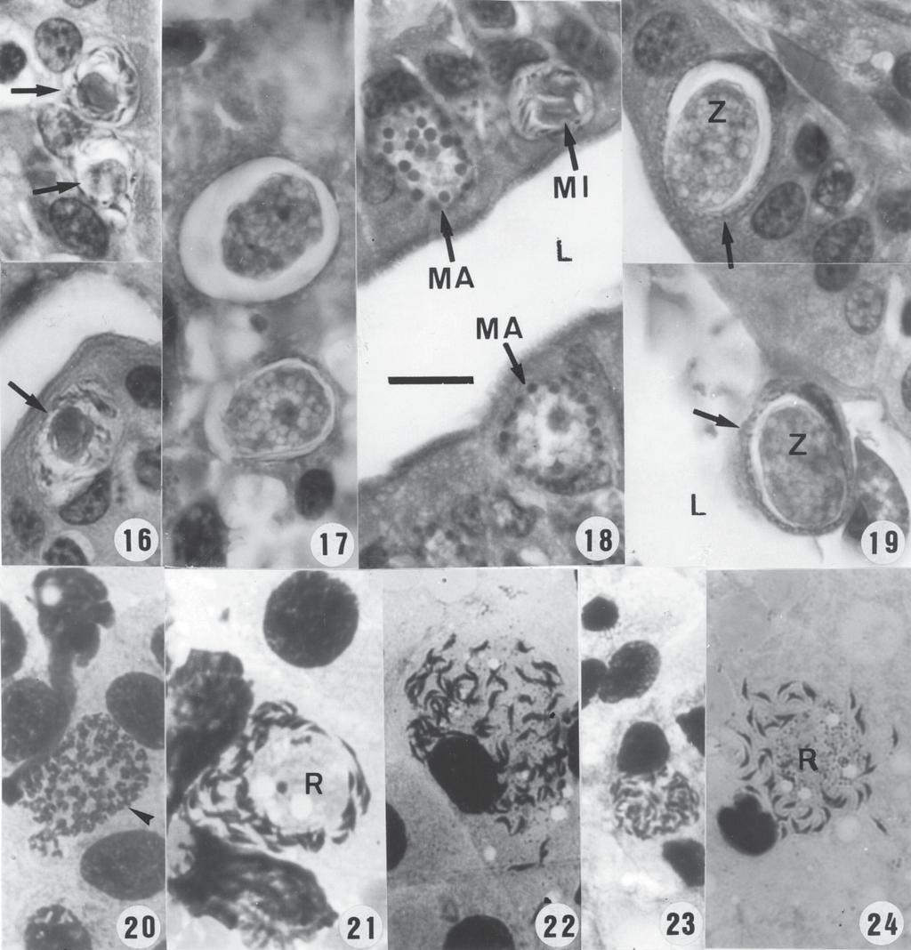 4 Eimeria spp. of Dasyprocta leporina Ralph Lainson et al. Eimeria species of Dasyprocta leporina. Endogenous stages of Eimeria cotiae in epithelial cells of the ileum.