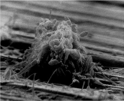 The Biofilm as survival mechanism Biofilms are survival mechanisms of clinically relevant microorganisms.