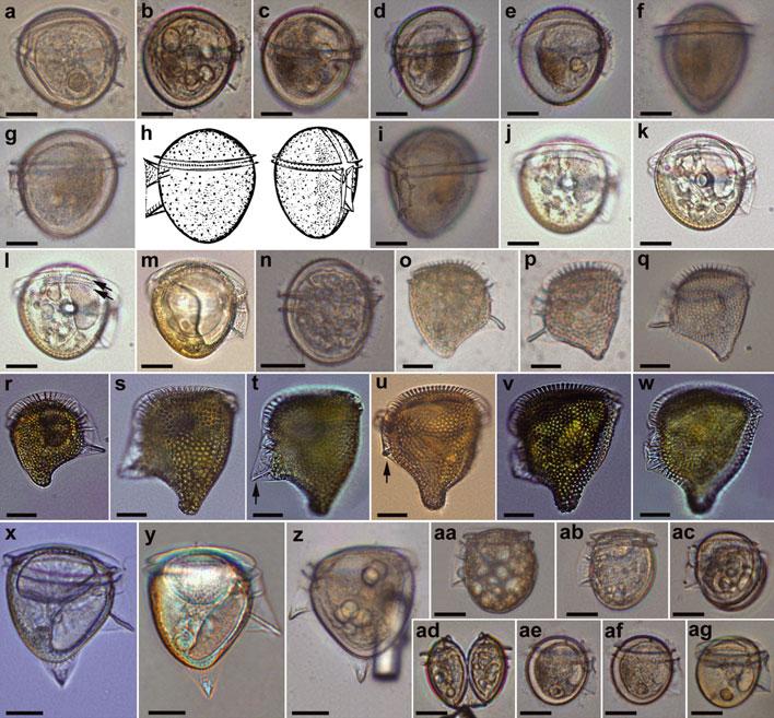 396 FERNANDO GÓMEZ ET AL. FIG. 2. Light micrographs of Phalacroma.