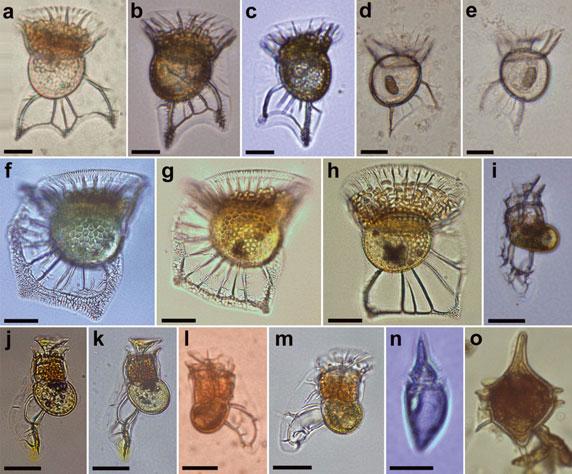 398 FERNANDO GÓMEZ ET AL. FIG. 4. Light micrographs of Ornithocercus, Histioneis, and Oxyphysis collected for single-cell PCR analysis.