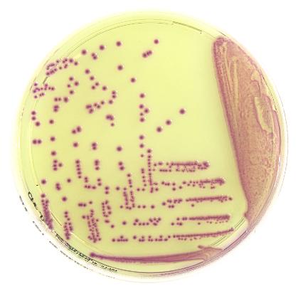 The ESBL-producing Enterobacteriaceae are responsible of severe hospital-acquired infections.