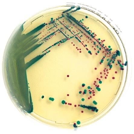 Enterococcus faecalis directly from clinical specimens. VRE have recently been recognized as one of the most severe cause of nosocomial infections.
